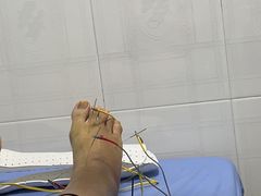 -广州中医药大学第三附属医院(骨伤科分院)