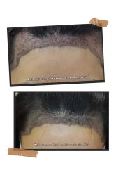 -熙朵美学植发·连锁品牌