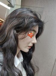 体验后-深圳广和门诊部·整形医疗美容