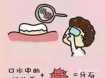 牙结石是牙齿周围的一种紧密的致密物附着在牙齿或者是牙