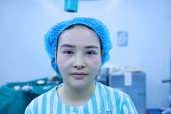 -丰联丽格医疗美容·联合丽格眼整形中心