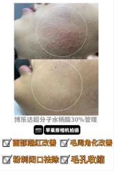 -E.beauty驻颜·痘敏肌调理中心