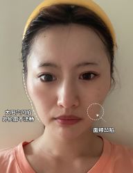 体验前-杭州奥拉克医疗美容门诊部