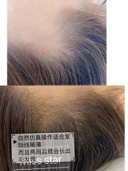-MISS STAR·半永久纹眉·发际线·美瞳线