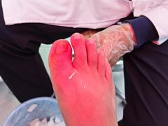 -世龙世家甲沟炎·灰指甲·嵌甲矫正·修脚(武侯区双楠店)