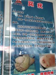 -百年美肤堂祛痦痣祛斑祛疣