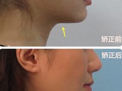 -柏乐口腔(南宁总院)
