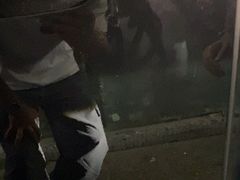 -鲨鱼皮汽车凹陷玻璃修复(静安店)