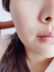 点击看大图 体验后-Dr.U博士医疗美容医院