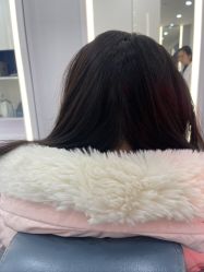 -大麦微针植发全国连锁