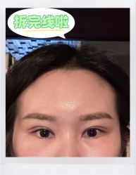 -素美医疗美容·西南眼鼻整形·修复基地