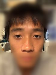 -天津健丽·去眼袋医疗美容机构