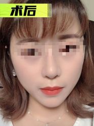 -素美医疗美容·西南眼鼻整形·修复基地