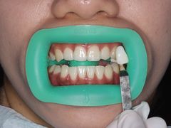 -瑞尔齿科(上海长风大悦城店)