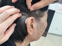 -海之声助听器峰力直营店深圳旗舰中心