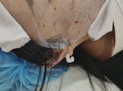 -广东韩妃整形外科医院