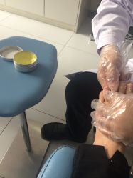 -派恩宜灰指甲·甲沟炎·鸡眼康护
