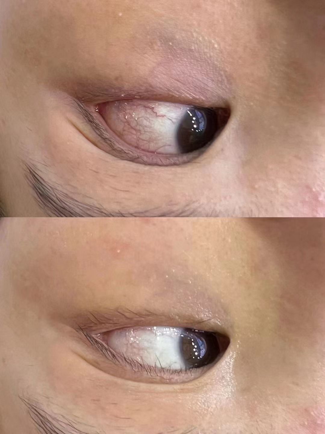 "人老珠黄"形容的就是双眼浑浊眼白偏黄红