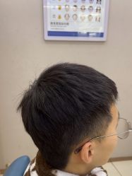 -大麦微针植发丨全国连锁