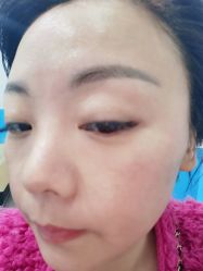 体验前-美莱医学美容医院