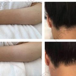 -HEYAN荷妍专业脱毛连锁机构
