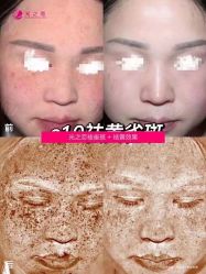 -星港国际·Skin皮肤专研·皮肤管理