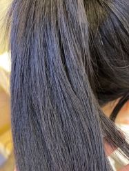 体验后-熙朵美学植发·连锁品牌