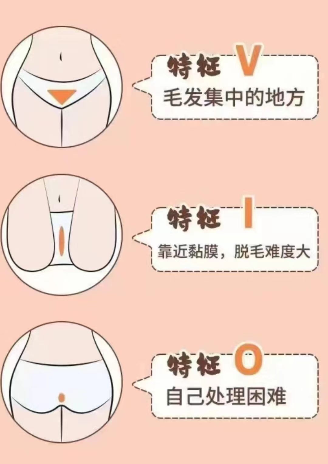 比基尼冰点脱毛