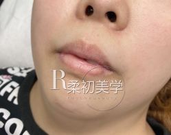 -RC半永久纹眉纹发际线