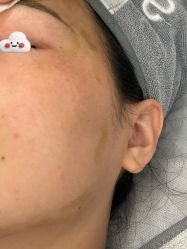 -skin79皮肤管理中心