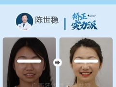 -柏乐口腔(南宁总院)