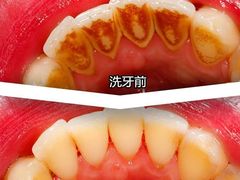 -团圆口腔·种植中心(锦江院区)