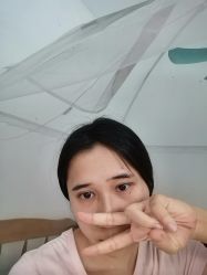 体验后-广州美莱医疗美容医院