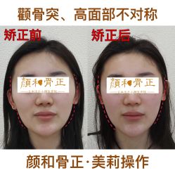 -颜和骨正·明哲式骨相美学整骨