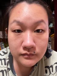 体验前-坤如玛丽·医疗美容中心
