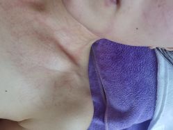 -俪姿·产后修复·开奶通乳(五一广场店)