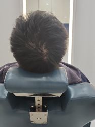 -大麦微针植发全国连锁