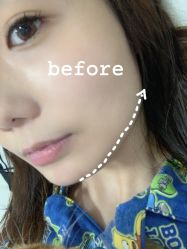 -agge蛋白医美
