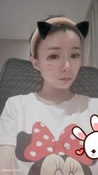 -大麦微针植发丨全国连锁