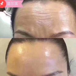 -美丽人生祛斑扁平疣汗管瘤中心