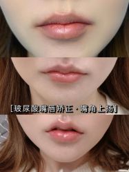 -上海漾颜医疗美容