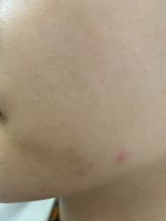-美瑞莎创美医疗美容