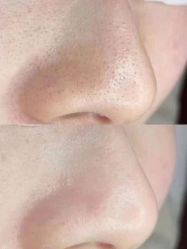 -美肤盾祛痘·问题肌头疗管理中心