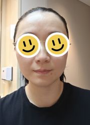 点击看大图 体验后-深圳艺星医疗美容医院