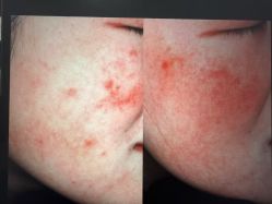 -和颜一美轻医美连锁