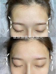 -上海漾颜医疗美容