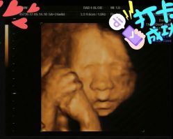 -杭州贝瑞斯美华妇儿医院·早孕·产检·儿科