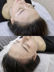 点击看大图 -西施无菌半永久纹绣眉眼影唇轻增发纹发际线