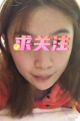 点击看大图 体验前-广州美莱医疗美容医院
