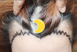 -大麦微针植发全国连锁